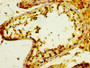 IHC image diluted at 1:300 and staining in paraffin-embedded human testis tissue performed on a Leica BondTM system. After dewaxing and hydration, antigen retrieval was mediated by high pressure in a citrate buffer (pH 6.0). Section was blocked with 10% normal goat serum 30min at RT. Then primary antibody (1% BSA) was incubated at 4°C overnight. The primary is detected by a biotinylated secondary antibody and visualized using an HRP conjugated SP system.