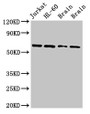 Western Blot; Positive WB detected in: Jurkat whole cell lysate, HL60 whole cell lysate, Rat brain tissue, Mouse brain tissue; All lanes: ARX antibody at 2.7µg/ml; Secondary; Goat polyclonal to rabbit IgG at 1/50000 dilution; Predicted band size: 59 kDa; Observed band size: 59 kDa;