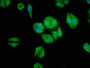 Immunofluorescence staining of HepG2 cells with CAC11263 at 1:66, counter-stained with DAPI. The cells were fixed in 4% formaldehyde, permeabilized using 0.2% Triton X-100 and blocked in 10% normal Goat Serum. The cells were then incubated with the antibody overnight at 4°C. The secondary antibody was Alexa Fluor 488-congugated AffiniPure Goat Anti-Rabbit IgG(H+L).