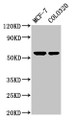 Western Blot; Positive WB detected in: MCF-7 whole cell lysate, Colo320 whole cell lysate; All lanes: MYOC antibody at 5.2µg/ml; Secondary; Goat polyclonal to rabbit IgG at 1/50000 dilution; Predicted band size: 57 kDa; Observed band size: 57 kDa