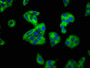 Immunofluorescence staining of HepG2 cells with CAC11268 at 1:100, counter-stained with DAPI. The cells were fixed in 4% formaldehyde, permeabilized using 0.2% Triton X-100 and blocked in 10% normal Goat Serum. The cells were then incubated with the antibody overnight at 4°C. The secondary antibody was Alexa Fluor 488-congugated AffiniPure Goat Anti-Rabbit IgG(H+L).