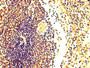 IHC image diluted at 1:300 and staining in paraffin-embedded human spleen tissue performed on a Leica BondTM system. After dewaxing and hydration, antigen retrieval was mediated by high pressure in a citrate buffer (pH 6.0). Section was blocked with 10% normal goat serum 30min at RT. Then primary antibody (1% BSA) was incubated at 4°C overnight. The primary is detected by a biotinylated secondary antibody and visualized using an HRP conjugated SP system.