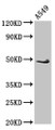 Western Blot; Positive WB detected in: A549 whole cell lysate; All lanes: EDAR antibody at 2.7µg/ml; Secondary; Goat polyclonal to rabbit IgG at 1/50000 dilution; Predicted band size: 49, 52 kDa; Observed band size: 49 kDa