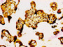 IHC image diluted at 1:500 and staining in paraffin-embedded human placenta tissue performed on a Leica BondTM system. After dewaxing and hydration, antigen retrieval was mediated by high pressure in a citrate buffer (pH 6.0). Section was blocked with 10% normal goat serum 30min at RT. Then primary antibody (1% BSA) was incubated at 4°C overnight. The primary is detected by a biotinylated secondary antibody and visualized using an HRP conjugated SP system.