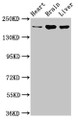 Western Blot; Positive WB detected in: Rat heart tissue, Mouse brain tissue, Mouse liver tissue; All lanes: ARFGEF2 antibody at 3.2µg/ml; Secondary; Goat polyclonal to rabbit IgG at 1/50000 dilution; Predicted band size: 203 kDa; Observed band size: 203 kDa;