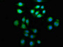 Immunofluorescence staining of A549 cells with CAC11275 at 1:133, counter-stained with DAPI. The cells were fixed in 4% formaldehyde, permeabilized using 0.2% Triton X-100 and blocked in 10% normal Goat Serum. The cells were then incubated with the antibody overnight at 4°C. The secondary antibody was Alexa Fluor 488-congugated AffiniPure Goat Anti-Rabbit IgG(H+L).