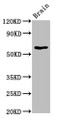 Western Blot; Positive WB detected in: Rat brain tissue; All lanes: HEXA antibody at 5.8µg/ml; Secondary; Goat polyclonal to rabbit IgG at 1/50000 dilution; Predicted band size: 61, 20 kDa; Observed band size: 61 kDa;