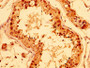 IHC image diluted at 1:400 and staining in paraffin-embedded human testis tissue performed on a Leica BondTM system. After dewaxing and hydration, antigen retrieval was mediated by high pressure in a citrate buffer (pH 6.0). Section was blocked with 10% normal goat serum 30min at RT. Then primary antibody (1% BSA) was incubated at 4°C overnight. The primary is detected by a biotinylated secondary antibody and visualized using an HRP conjugated SP system.