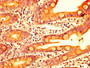 IHC image diluted at 1:400 and staining in paraffin-embedded human small intestine tissue performed on a Leica BondTM system. After dewaxing and hydration, antigen retrieval was mediated by high pressure in a citrate buffer (pH 6.0). Section was blocked with 10% normal goat serum 30min at RT. Then primary antibody (1% BSA) was incubated at 4°C overnight. The primary is detected by a biotinylated secondary antibody and visualized using an HRP conjugated SP system.