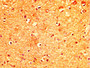 IHC image diluted at 1:300 and staining in paraffin-embedded human brain tissue performed on a Leica BondTM system. After dewaxing and hydration, antigen retrieval was mediated by high pressure in a citrate buffer (pH 6.0). Section was blocked with 10% normal goat serum 30min at RT. Then primary antibody (1% BSA) was incubated at 4°C overnight. The primary is detected by a biotinylated secondary antibody and visualized using an HRP conjugated SP system.