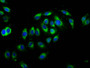 Immunofluorescence staining of A549 cells with CAC11289 at 1:66, counter-stained with DAPI. The cells were fixed in 4% formaldehyde, permeabilized using 0.2% Triton X-100 and blocked in 10% normal Goat Serum. The cells were then incubated with the antibody overnight at 4°C. The secondary antibody was Alexa Fluor 488-congugated AffiniPure Goat Anti-Rabbit IgG(H+L).