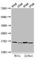 Western Blot; Positive WB detected in: Hela cell acid extracts, Jurkat cell acid extracts; All lanes: HIST1H3A antibody at 1µg/ml; Secondary; Goat polyclonal to rabbit IgG at 1/50000 dilution; Predicted band size: 16 kDa; Observed band size: 16 kDa