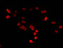 Immunofluorescent analysis of Hela cells using CAC11291 at dilution of 1:100 andCy3-congugatedGoatAnti-RabbitIgG