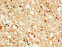 Immunohistochemistry of paraffin-embedded human brain tissue using CAC11293 at dilution of 1:100