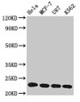 Western Blot; Positive WB detected in: Hela whole cell lysate, MCF-7 whole cell lysate, U87 whole cell lysate, K562 whole cell lysate; All lanes: HIST1H1B antibody at 1µg/ml; Secondary; Goat polyclonal to rabbit IgG at 1/50000 dilution; Predicted band size: 23 kDa; Observed band size: 23 kDa