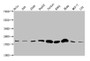 Western Blot; Positive WB detected in: Hela whole cell lysate, 293 whole cell lysate, A549 whole cell lysate, HepG2 whole cell lysate, Jurkat whole cell lysate, K562 whole cell lysate, HL60 whole cell lysate, MCF-7 whole cell lysate, LO2 whole cell lysate; All lanes: HIST1H1E antibody at 1:500; Secondary; Goat polyclonal to rabbit IgG at 1/40000 dilution; Predicted band size: 22 kDa; Observed band size: 22 kDa