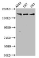 Western Blot; ,Positive WB detected in: A549 whole cell lysate, U87 whole cell lysate, 293 whole cell lysate; ,All lanes: AGRN antibody at 7.5µg/ml; ,Secondary; ,Goat polyclonal to rabbit IgG at 1/50000 dilution; ,Predicted band size: 218, 206, 217, 215 kDa; ,Observed band size: 218 kDa
