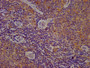 IHC image of CAC11308 diluted at 1:200 and staining in paraffin-embedded human lymph node tissue performed on a Leica BondTM system. After dewaxing and hydration, antigen retrieval was mediated by high pressure in a citrate buffer (pH 6.0). Section was blocked with 10% normal goat serum 30min at RT. Then primary antibody (1% BSA) was incubated at 4°C overnight. The primary is detected by a biotinylated secondary antibody and visualized using an HRP conjugated SP system.