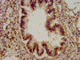 IHC image diluted at 1:200 and staining in paraffin-embedded human lung tissue performed on a Leica BondTM system. After dewaxing and hydration, antigen retrieval was mediated by high pressure in a citrate buffer (pH 6.0). Section was blocked with 10% normal goat serum 30min at RT. Then primary antibody (1% BSA) was incubated at 4°C overnight. The primary is detected by a biotinylated secondary antibody and visualized using an HRP conjugated SP system.