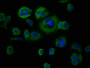 Immunofluorescence staining of MCF-7 cells with CAC11308 at 1:66, counter-stained with DAPI. The cells were fixed in 4% formaldehyde, permeabilized using 0.2% Triton X-100 and blocked in 10% normal Goat Serum. The cells were then incubated with the antibody overnight at 4°C. The secondary antibody was Alexa Fluor 488-congugated AffiniPure Goat Anti-Rabbit IgG(H+L).