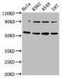 Western Blot; Positive WB detected in: Hela whole cell lysate, K562 whole cell lysate, A549 whole cell lysate, U87 whole cell lysate; All lanes: TOX antibody at 5.2µg/ml; Secondary; Goat polyclonal to rabbit IgG at 1/50000 dilution; Predicted band size: 58 kDa; Observed band size: 58 kDa