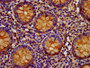 IHC image diluted at 1:400 and staining in paraffin-embedded human appendix tissue performed on a Leica BondTM system. After dewaxing and hydration, antigen retrieval was mediated by high pressure in a citrate buffer (pH 6.0). Section was blocked with 10% normal goat serum 30min at RT. Then primary antibody (1% BSA) was incubated at 4°C overnight. The primary is detected by a biotinylated secondary antibody and visualized using an HRP conjugated SP system.