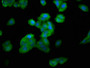 Immunofluorescence staining of HepG2 cells with CAC11322 at 1:100, counter-stained with DAPI. The cells were fixed in 4% formaldehyde, permeabilized using 0.2% Triton X-100 and blocked in 10% normal Goat Serum. The cells were then incubated with the antibody overnight at 4°C. The secondary antibody was Alexa Fluor 488-congugated AffiniPure Goat Anti-Rabbit IgG(H+L).