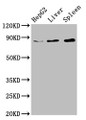 Western Blot; Positive WB detected in: HepG2 whole cell lysate, Rat liver tissue, Mouse spleen tissue; All lanes: NSUN2 antibody at 6.7µg/ml; Secondary; Goat polyclonal to rabbit IgG at 1/50000 dilution; Predicted band size: 87, 83, 60 kDa; Observed band size: 87 kDa;