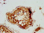 IHC image diluted at 1:200 and staining in paraffin-embedded human testis tissue performed on a Leica BondTM system. After dewaxing and hydration, antigen retrieval was mediated by high pressure in a citrate buffer (pH 6.0). Section was blocked with 10% normal goat serum 30min at RT. Then primary antibody (1% BSA) was incubated at 4°C overnight. The primary is detected by a biotinylated secondary antibody and visualized using an HRP conjugated SP system.