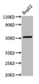 Western Blot; Positive WB detected in: HepG2 whole cell lysate; All lanes: WLS antibody at 5.4µg/ml; Secondary; Goat polyclonal to rabbit IgG at 1/50000 dilution; Predicted band size: 63, 52 kDa; Observed band size: 52 kDa