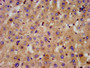 IHC image diluted at 1:300 and staining in paraffin-embedded human liver tissue performed on a Leica BondTM system. After dewaxing and hydration, antigen retrieval was mediated by high pressure in a citrate buffer (pH 6.0). Section was blocked with 10% normal goat serum 30min at RT. Then primary antibody (1% BSA) was incubated at 4°C overnight. The primary is detected by a biotinylated secondary antibody and visualized using an HRP conjugated SP system.