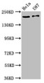 Western Blot; Positive WB detected in: Hela whole cell lysate, U87 whole cell lysate; All lanes: SCN10A antibody at 12µg/ml; Secondary; Goat polyclonal to rabbit IgG at 1/50000 dilution; Predicted band size: 221 kDa; Observed band size: 221 kDa;