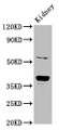 Western Blot; Positive WB detected in: Rat kidney tissue; All lanes: CD300LG antibody at 6µg/ml; Secondary; Goat polyclonal to rabbit IgG at 1/50000 dilution; Predicted band size: 37, 27, 25, 34, 30 kDa; Observed band size: 37 kDa;