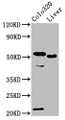 Western Blot; Positive WB detected in: Colo320 whole cell lysate, Rat liver tissue; All lanes: OLFM4 antibody at 10µg/ml; Secondary; Goat polyclonal to rabbit IgG at 1/50000 dilution; Predicted band size: 58 kDa; Observed band size: 58 kDa;