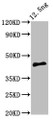 Western Blot; Positive WB detected in Recombinant protein; All lanes: PMRT15 antibody at 5µg/ml; Secondary; Goat polyclonal to rabbit IgG at 1/50000 dilution; Predicted band size: 44 kDa; Observed band size: 44 kDa;
