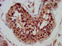 IHC image of CAC11339 diluted at 1:300 and staining in paraffin-embedded human testis tissue performed on a Leica BondTM system. After dewaxing and hydration, antigen retrieval was mediated by high pressure in a citrate buffer (pH 6.0). Section was blocked with 10% normal goat serum 30min at RT. Then primary antibody (1% BSA) was incubated at 4°C overnight. The primary is detected by a biotinylated secondary antibody and visualized using an HRP conjugated SP system.