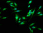 Immunofluorescence staining of Hela cells with CAC11339 at 1:100, counter-stained with DAPI. The cells were fixed in 4% formaldehyde, permeabilized using 0.2% Triton X-100 and blocked in 10% normal Goat Serum. The cells were then incubated with the antibody overnight at 4°C. The secondary antibody was Alexa Fluor 488-congugated AffiniPure Goat Anti-Rabbit IgG(H+L).