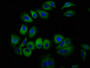 Immunofluorescence staining of A549 cells with CAC11353 at 1:100, counter-stained with DAPI. The cells were fixed in 4% formaldehyde, permeabilized using 0.2% Triton X-100 and blocked in 10% normal Goat Serum. The cells were then incubated with the antibody overnight at 4°C. The secondary antibody was Alexa Fluor 488-congugated AffiniPure Goat Anti-Rabbit IgG(H+L).