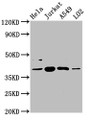 Western Blot; Positive WB detected in: Hela whole cell lysate, Jurkat whole cell lysate, A549 whole cell lysate, LO2 whole cell lysate; All lanes: SHARPIN antibody at 5.4µg/ml; Secondary; Goat polyclonal to rabbit IgG at 1/50000 dilution; Predicted band size: 40, 34 kDa; Observed band size: 40 kDa