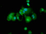 Immunofluorescence staining of MCF-7 cells with CAC11357 at 1:166, counter-stained with DAPI. The cells were fixed in 4% formaldehyde, permeabilized using 0.2% Triton X-100 and blocked in 10% normal Goat Serum. The cells were then incubated with the antibody overnight at 4°C. The secondary antibody was Alexa Fluor 488-congugated AffiniPure Goat Anti-Rabbit IgG(H+L).