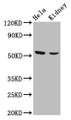 Western Blot; Positive WB detected in: Hela whole cell lysate, Mouse kidney tissue; All lanes: POLK antibody at 4.2µg/ml; Secondary; Goat polyclonal to rabbit IgG at 1/50000 dilution; Predicted band size: 99, 55, 77, 43, 56, 53, 89 kDa; Observed band size: 53 kDa