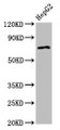 Western Blot; Positive WB detected in: HepG2 whole cell lysate; All lanes: AGPS antibody at 2.7µg/ml; Secondary; Goat polyclonal to rabbit IgG at 1/50000 dilution; Predicted band size: 73 kDa; Observed band size: 73 kDa
