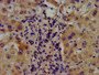IHC image of CAC11369 diluted at 1:400 and staining in paraffin-embedded human liver tissue performed on a Leica BondTM system. After dewaxing and hydration, antigen retrieval was mediated by high pressure in a citrate buffer (pH 6.0). Section was blocked with 10% normal goat serum 30min at RT. Then primary antibody (1% BSA) was incubated at 4°C overnight. The primary is detected by a biotinylated secondary antibody and visualized using an HRP conjugated SP system.