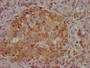 IHC image diluted at 1:400 and staining in paraffin-embedded human pancreatic tissue performed on a Leica BondTM system. After dewaxing and hydration, antigen retrieval was mediated by high pressure in a citrate buffer (pH 6.0). Section was blocked with 10% normal goat serum 30min at RT. Then primary antibody (1% BSA) was incubated at 4°C overnight. The primary is detected by a biotinylated secondary antibody and visualized using an HRP conjugated SP system.