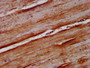IHC image diluted at 1:100 and staining in paraffin-embedded human skeletal muscle tissue performed on a Leica BondTM system. After dewaxing and hydration, antigen retrieval was mediated by high pressure in a citrate buffer (pH 6.0). Section was blocked with 10% normal goat serum 30min at RT. Then primary antibody (1% BSA) was incubated at 4°C overnight. The primary is detected by a biotinylated secondary antibody and visualized using an HRP conjugated SP system.