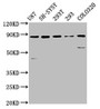 Western Blot; Positive WB detected in: U87 whole cell lysate, SH-SY5Y whole cell lysate, 293T whole cell lysate, 293 whole cell lysate, Colo320 whole cell lysate; All lanes: SLC26A4 antibody at 5.7µg/ml; Secondary; Goat polyclonal to rabbit IgG at 1/50000 dilution; Predicted band size: 86, 40 kDa; Observed band size: 86 kDa