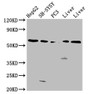 Western Blot; Positive WB detected in: HepG2 whole cell lysate, SH-SY5Y whole cell lysate, PC-3 whole cell lysate, Rat liver tissue, Mouse liver tissue; All lanes: UGT1A1 antibody at 4.2µg/ml; Secondary; Goat polyclonal to rabbit IgG at 1/50000 dilution; Predicted band size: 60, 50 kDa; Observed band size: 60 kDa