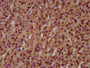 IHC image diluted at 1:600 and staining in paraffin-embedded human adrenal gland tissue performed on a Leica BondTM system. After dewaxing and hydration, antigen retrieval was mediated by high pressure in a citrate buffer (pH 6.0). Section was blocked with 10% normal goat serum 30min at RT. Then primary antibody (1% BSA) was incubated at 4°C overnight. The primary is detected by a biotinylated secondary antibody and visualized using an HRP conjugated SP system.
