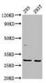 Western Blot; Positive WB detected in: 293 whole cell lysate, 293T whole cell lysate; All lanes: AANAT antibody at 7.5µg/ml; Secondary; Goat polyclonal to rabbit IgG at 1/50000 dilution; Predicted band size: 24, 29 kDa; Observed band size: 29 kDa;