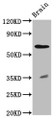 Western Blot; Positive WB detected in: Rat brain tissue; All lanes: RPE65 antibody at 2.3µg/ml; Secondary; Goat polyclonal to rabbit IgG at 1/50000 dilution; Predicted band size: 61 kDa; Observed band size: 61 kDa;